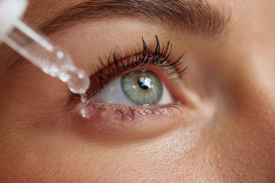 Young woman applying eye drops for dry eye relief and vision care, highlighting personal healthcare, wellness routine, and medical treatment concept